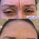کلینیک پوست،مو،زیبایی،مرکز لیزر ‌پرنسا