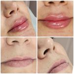 کلینیک زیبایی و لیزر مایا (دکتر وحیدی)