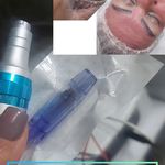 پروتئین و بوتاکس پیک