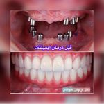 مركز دندانپزشکی دکترفرنوش عیوضی