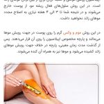 اپیلاسیون نادره