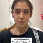 کلینیک زیبایی شایلی