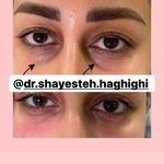 مطب پوست و لیزر