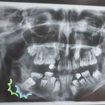 دکتر سمیه کرمی