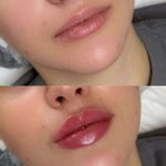 کلینیک پوست و زیبایی ژیلاوَش