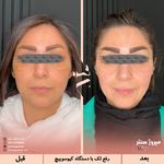 مرکز پزشکی و زیبایی میروژ سنتر
