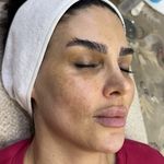 خدمات تخصصی پاکسازی پوست و فیشال مریم