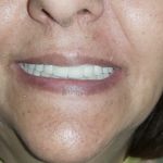 مطب ایمپلنت دکتر نیما شفیعی