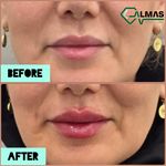کلینیک پوست،زیبایی ولیزر وکاشت مو الماس