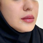 مرکز زیبایی دکتر فاطمه طرزی