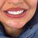 دکتر فرشته احمدی دندانپزشک(بیمه نداریم)