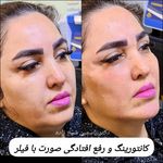 کلینیک پوست مو زیبایی و لیزر کیمیا