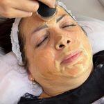 مرکز فیشال و پاکسازی پوست آنجلا اسکین