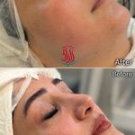 فیشال،مرکزتخصصی مراقبت پوست و مو