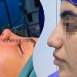 جراحی بینی دکتر اسدالله پور
