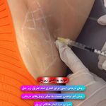 کلینیک پوست و مو و لیزر نیلوفر آبی