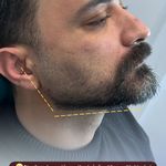 مرکز لیزر و کلینیک زیبایی پریفا