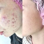 فیشال و‌ مراقبت پوستی|نیوشا اکبری