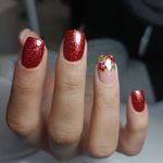 کاشت ناخن پلطالشان