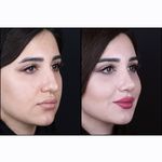 دکتر بهروز جلالی (جراحی بینی لیفت صورت)