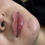 مرکز لیزر و کلینیک زیبایی پریفا