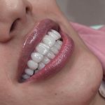 کلینیک‌دندانپزشکی دنتال آرنا-بیمه نیستیم