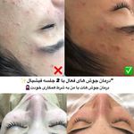 لیزر موهای زائد و پاکسازی پوست نوترسا