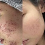 کلینیک هایفوتراپی جعفرزاده