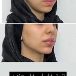 کلینیک زیبایی و جوانسازی پوست و مو الین