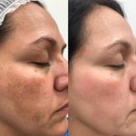 آموزش و خدمات پوست و فیشال رویا باقریان