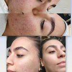 فیشال درمانی و پاکسازی پوست میرجلیلی