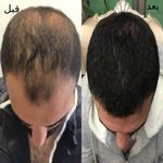 کلینیک زیبایی آوان |
