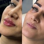 کلینیک تخصصی زیبایی و لیزر ویان