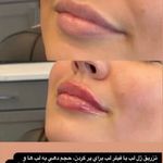 كلينيك زيبايي پوستينو
