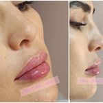 کلینیک زیبایی و لیزر مایا (دکتر وحیدی)