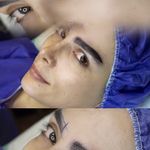 مطب پوست، مو و زیبایی و لیزر شبیرا
