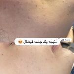 مرکز لیزر ،پوست و زیبایی کندی بیوتی