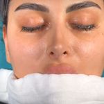 کلینیک زیبایی الماس کاملا اقساطی