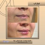 مطب پوست مو زیبایی فردوس شرق