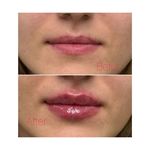 مطب زیبایی دکتر سیده زهرا حسینی