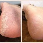 خدمات تخصصی پدیکور درمانی شیوا