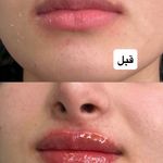 کلینیک پوست مو لیزر ونوس
