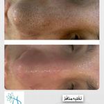 کلینیک پوست و مو و لیزر نیلوفر آبی