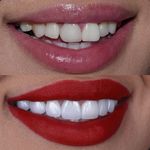 دندانپزشکی میلانا