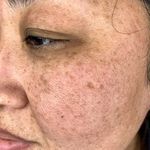 کلینیک فیشیال پوست صفا قم