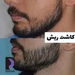 کلینیک زیبایی پوست و مو و لیزر پامچال