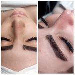 کلینیک لیزر وزیبایی پوست ومو آیشیل