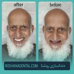 لابراتوار دندانسازی روشَنا