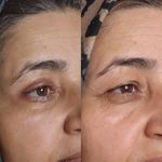 مجموعه زیبایی آتیماه