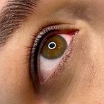 میکروبلیدینگ رویا